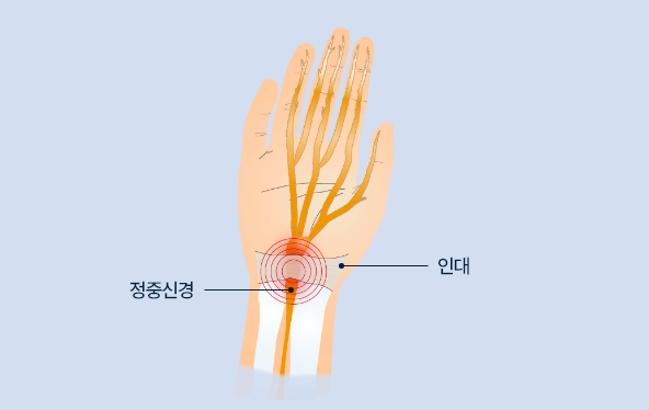 수술전